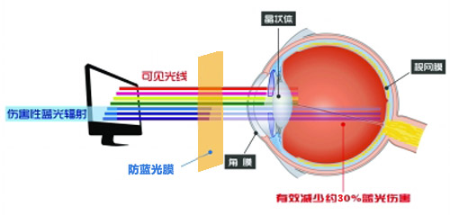 MR.好色破解版最新科技成果 好色丝瓜先生成護眼利器